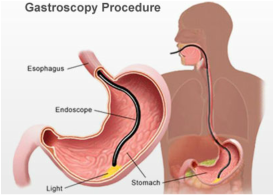 Gastroscopy by Melbourne Surgeon Mr Steven Karametos 